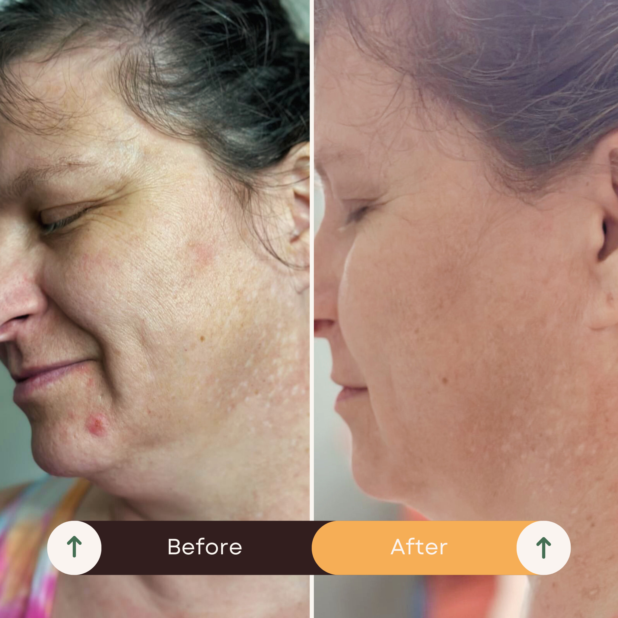 The Essential Line - Auybovan