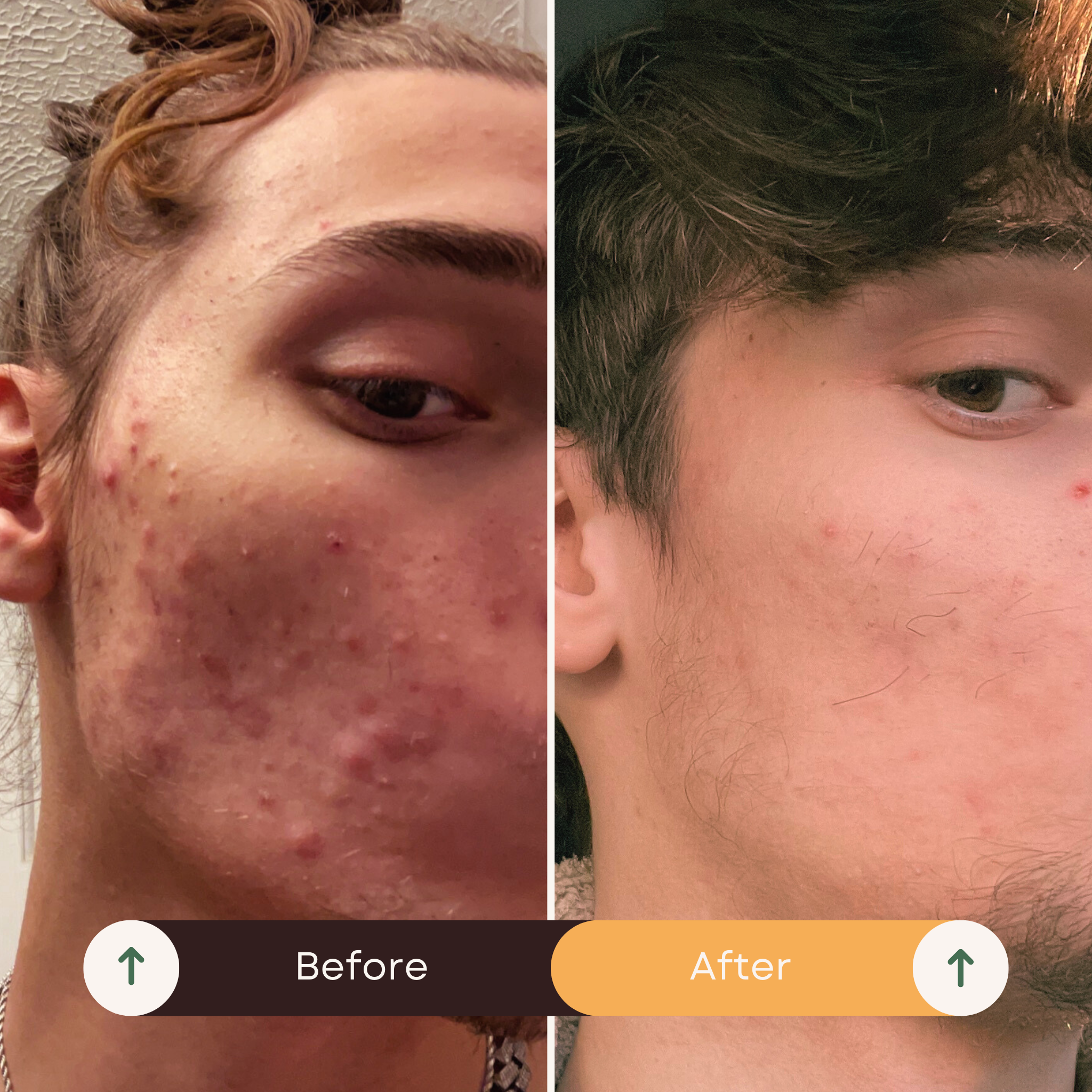 Purifying Essence - Auybovan