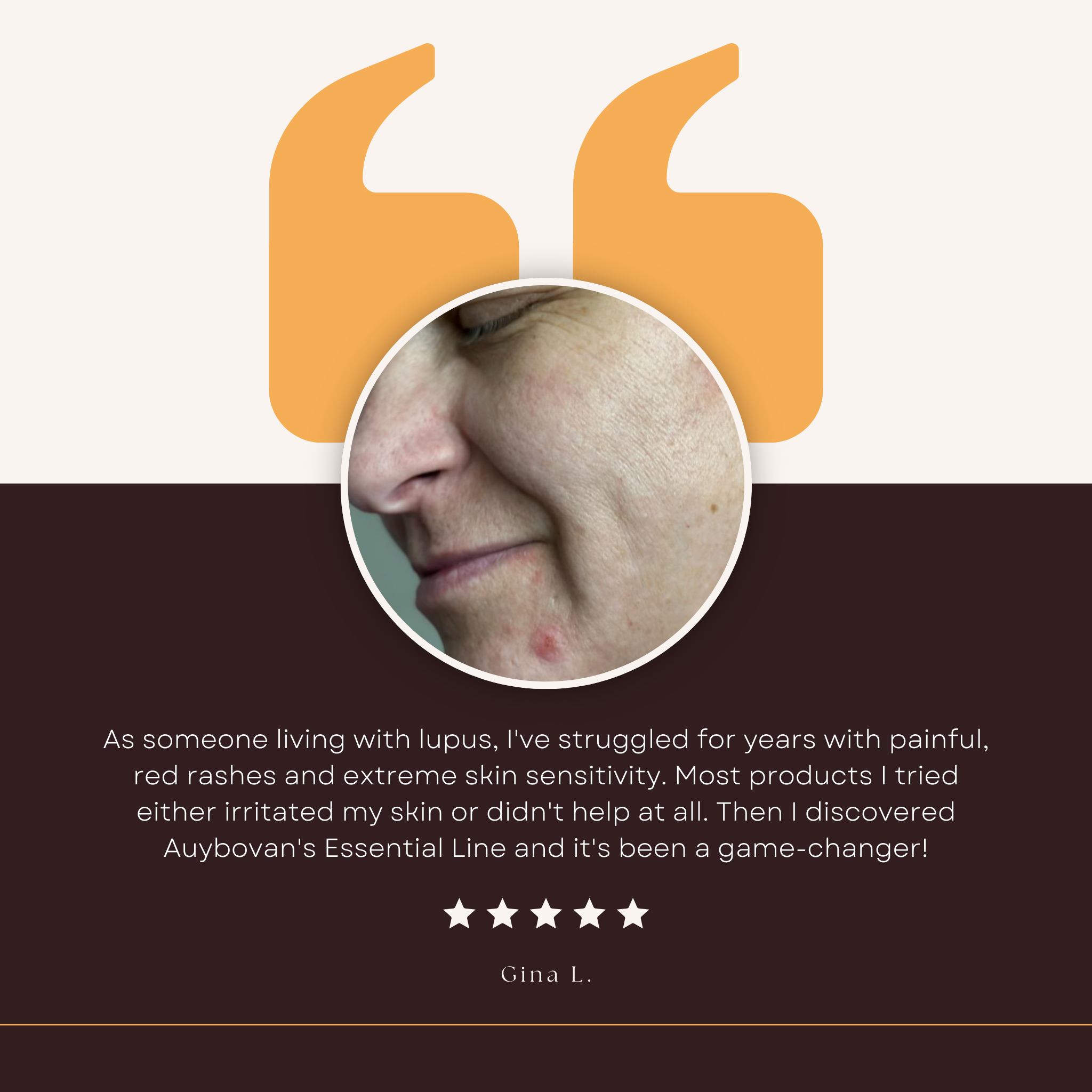 Purifying Essence - Auybovan