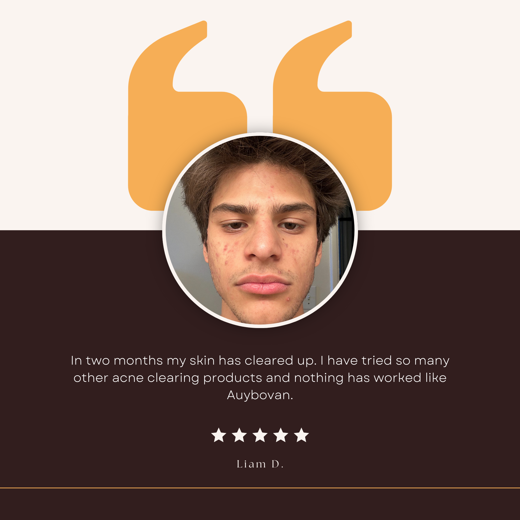 Cleansing Polish - Auybovan